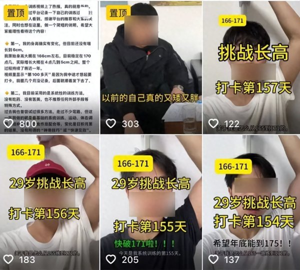 蜂窝配资 快30岁男子称身高从1米65增加到了1米71！骨科专家：别高兴得太早……